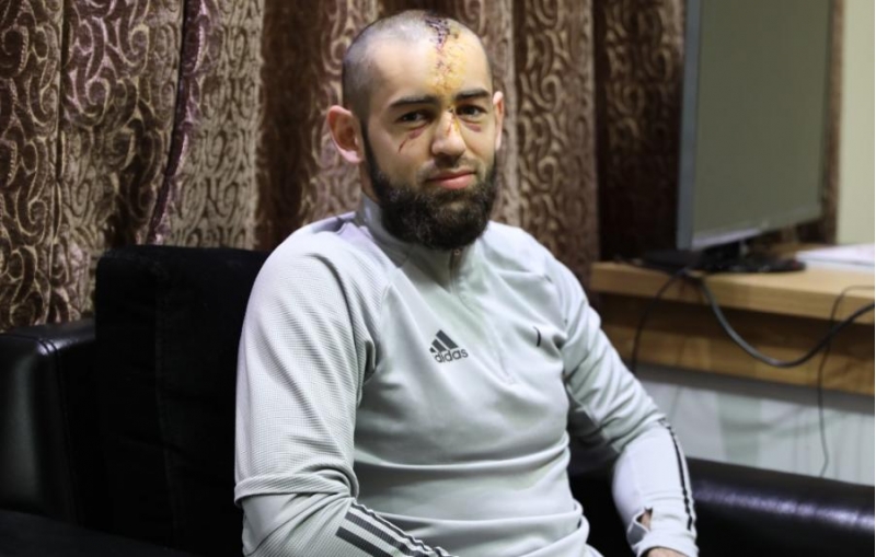 shahruddin-mehemmedeliyev-bashima-25-uzume-7-tikish-qoyulub