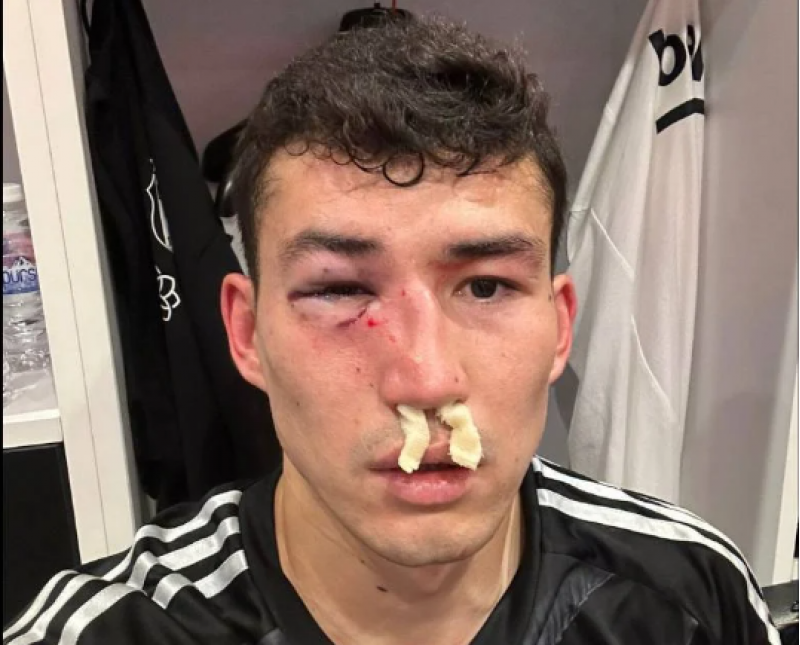 beshiktashin-zedelilerinin-son-durumu